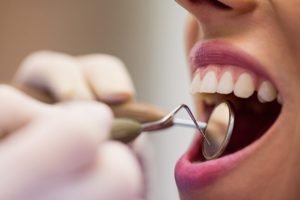 1786588265_dentist-examining-female-patient-with-tools-1024x683.jpg