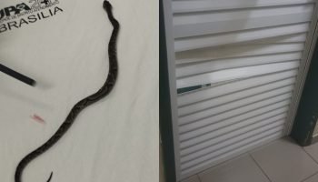 crianca-picada-cobra-jararaca