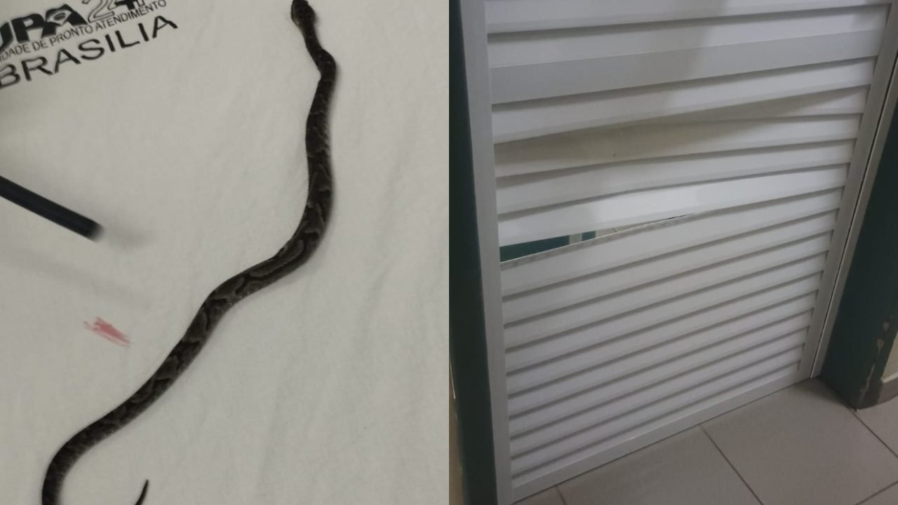 crianca-picada-cobra-jararaca