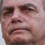 jair-bolsonaro-broncopneumonia-1