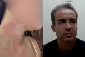 mulher-denunciou-jadson-por-agressao-01125400-0-20006657760202608101536.webp.webp
