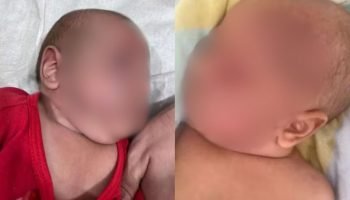 Foto: A criança sobreviveu após atendimento médico. (Reprodução/Freepik)